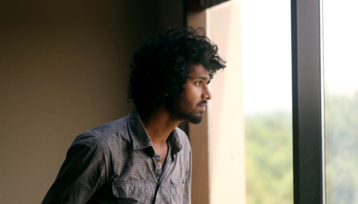 如何治疗男性脱发