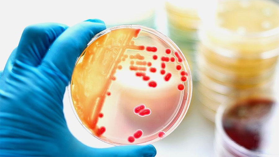 新冠病毒再次来袭，冷冻食品还能吃吗？