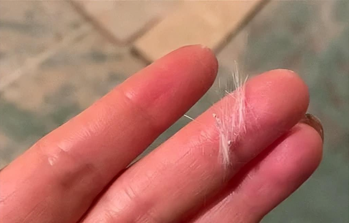 警惕！快递包裹里的“暴雨梨花针”已致多人失明，这些物品家家都有