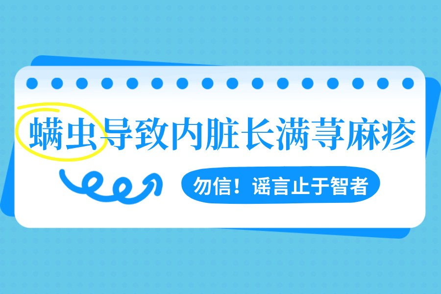 螨虫过多导致内脏长满荨麻疹?谣言止于智者