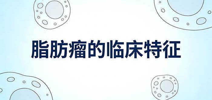脂肪瘤的临床特征